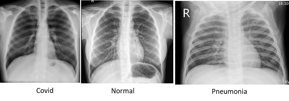 Sample Images of Chest X Rays 